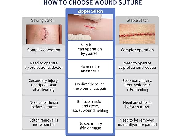 URAY  Emergency Wound Closure Device