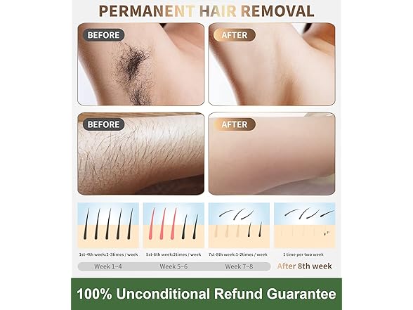 Gransumr IPL Laser Hair Removal Device Permanent