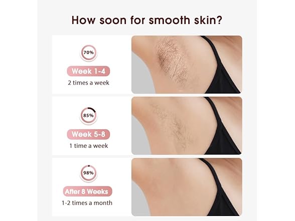 Laser Hair Removal with Cooling IPL