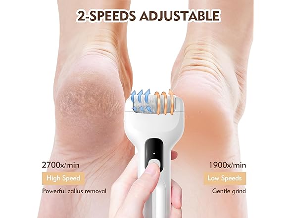 Callus Remover for Feet