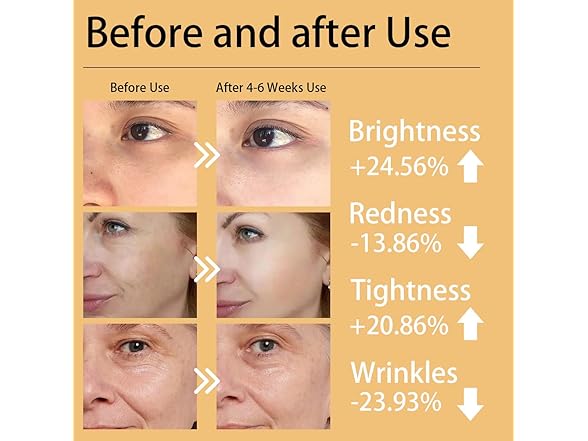 LED Red Light Therapy Face Mask & Neck