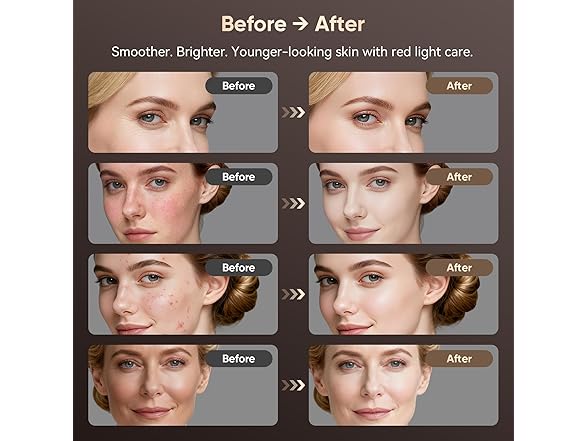 Red Light Therapy for Face
