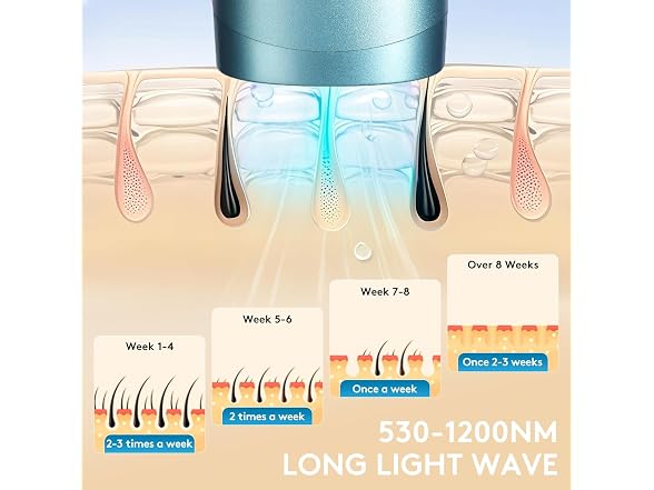 Laser Hair Removal for Women