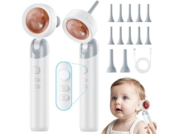 ASPOVEN 1080P HD Otoscope Ear Camera