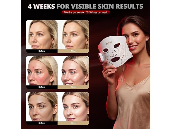 Wireless LED Red Light Therapy Mask
