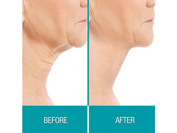Facial Anti Aging Skin Cream