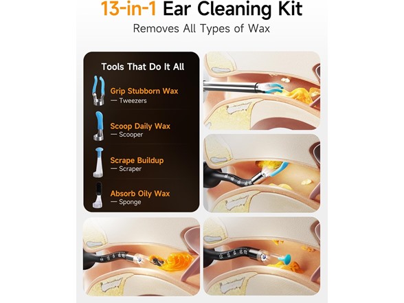 Ear Wax Removal Kit - 10MP Camera