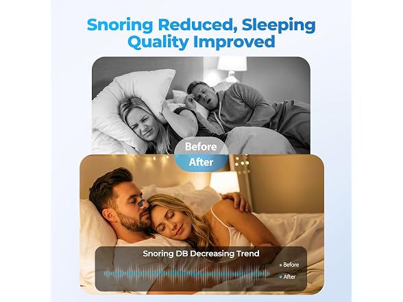 Hyuxeo Nasal Strips for Snoring