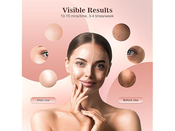 Red Light Therapy Mask