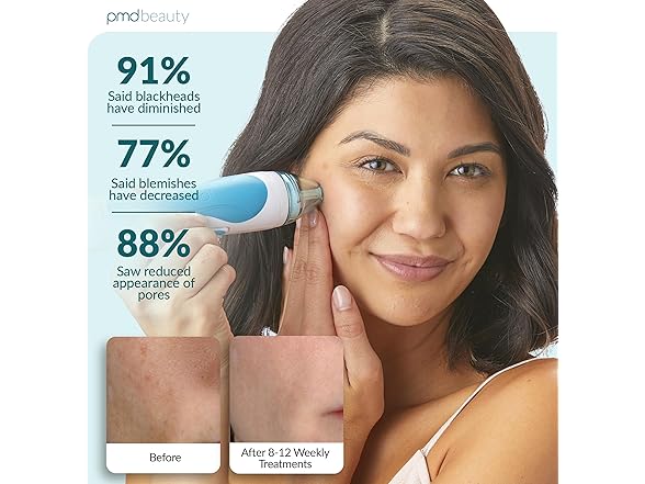 PMD Personal Microderm PMD Personal Microderm Pro - A