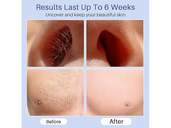 BLITZWAX Brazilian and Bikini Waxing Kit