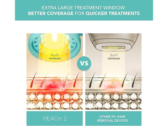FOREO PEACH 2 IPL Hair Removal Device