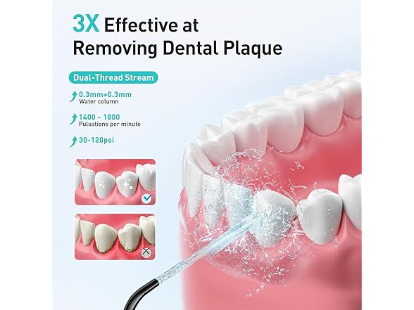 COSLUS Water Flosser Dental Pick (Black)