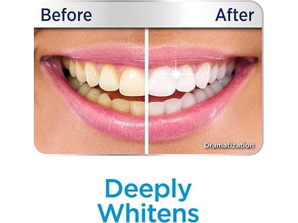 Ontel Coconut Teeth Whitener