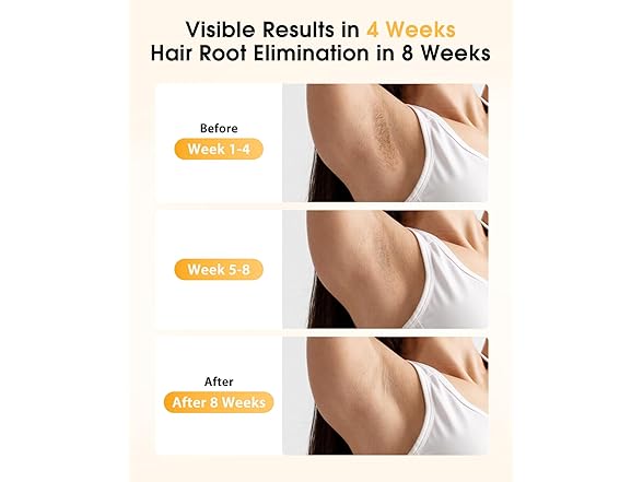 LYSMOSKI laser hair removal