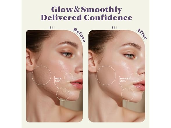 Bnu Dermaplane Razor Women Face Peach Fuzz and