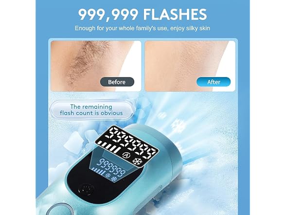 Laser Hair Removal for Women