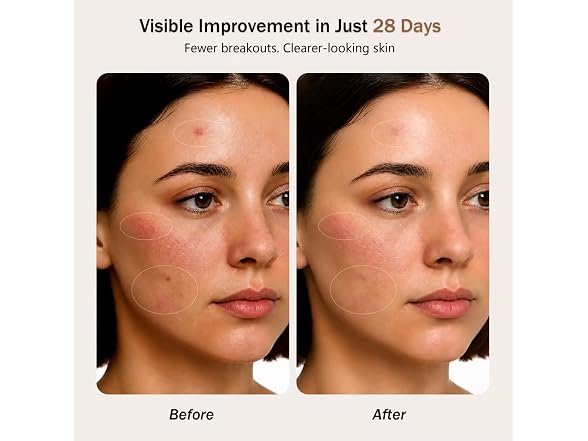 Aimilove Red Light Therapy Mask