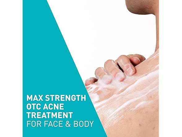 CeraVe Acne Foaming Cream Wash