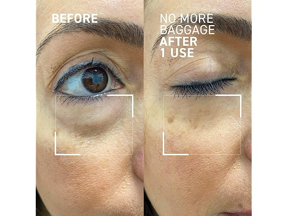 Dr. Brandt Needles No More, No More Baggage - 0.5 oz