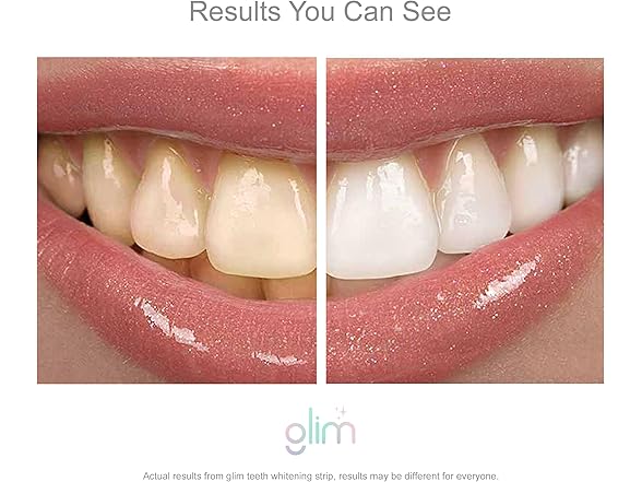 Glim Professional Teeth Whitening Strips