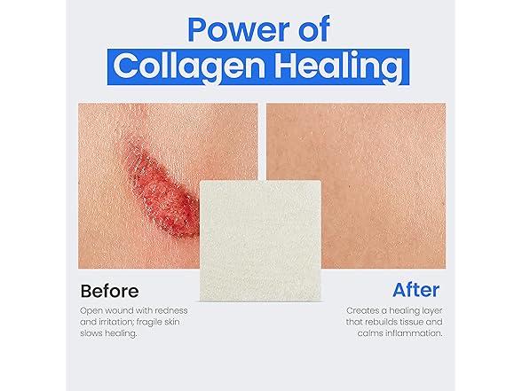 Simpurity Collagen Pads 5ct