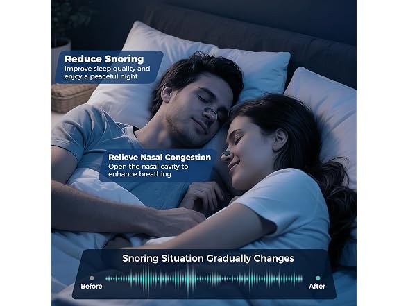 Trisewenic W2200 Nasal Strips for Snoring MSBT