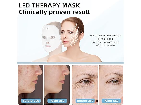 Blue Light Therapy Mask for Face