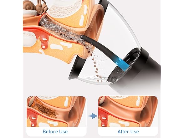 yakbio Electric Ear Cleaner