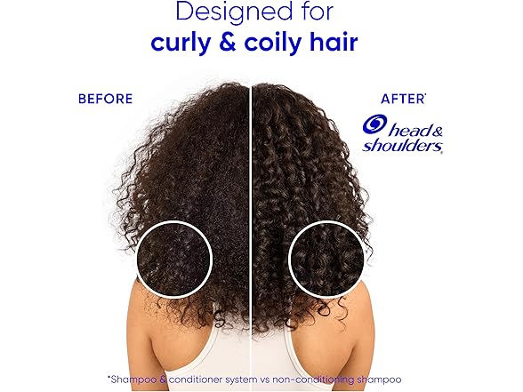 HEAD AND SHOULDERS SHEA 4P HEAD AND SHOULDERS SHEA BUTTER