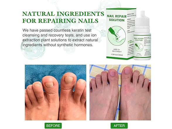Nail Drops for Treating Toenail Odor