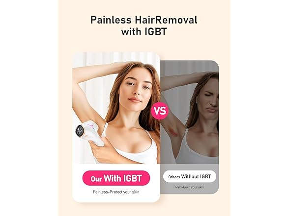 LYSMOSKI laser hair removal