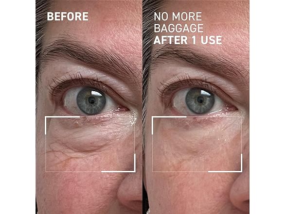 Dr. Brandt Needles No More, No More Baggage - 0.5 oz