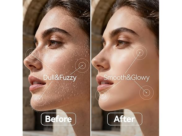 Sonic Dermaplane Razor