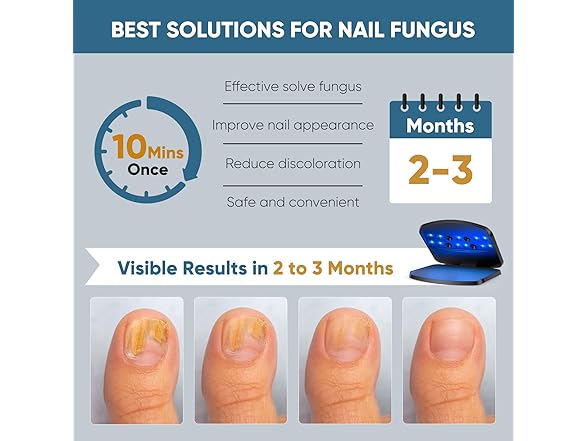 Nail Fungus Light Device