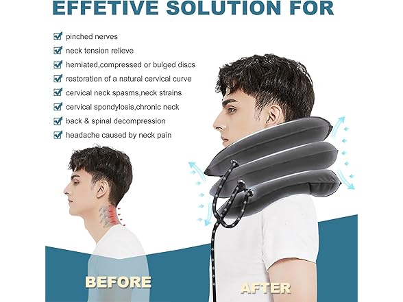 Pogcay Cervical Neck Traction Device
