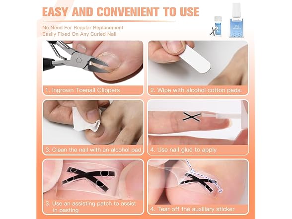 Ingrown Toenail Treatment Kit