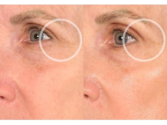 SiO Beauty Eye & Smile Lift - Eye & Smile