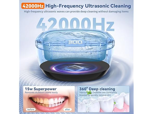 BEKOMIYA Ultrasonic Retainer Cleaner