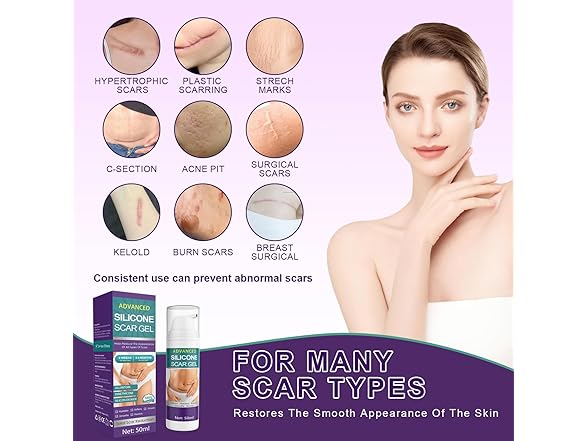 Tearich Scar Cream Gel