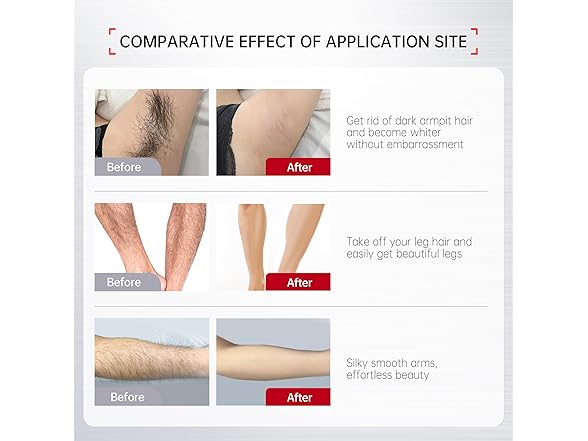 VGO Painless Hair Removal Cream