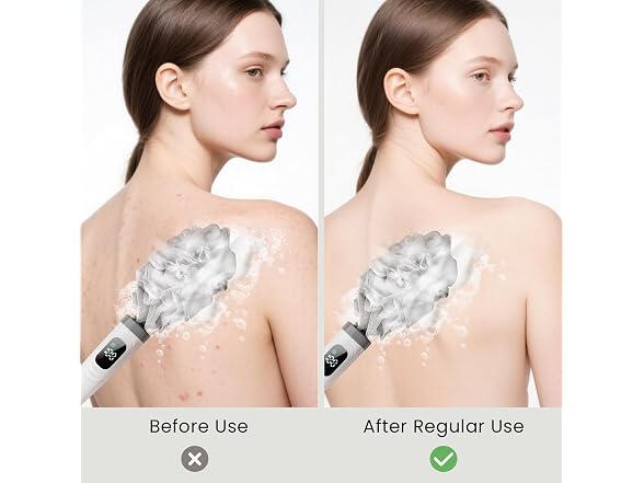 Electric Body Brush Back Scrubber Long