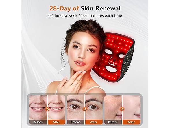RELEXNOW Red Light Therapy for Face