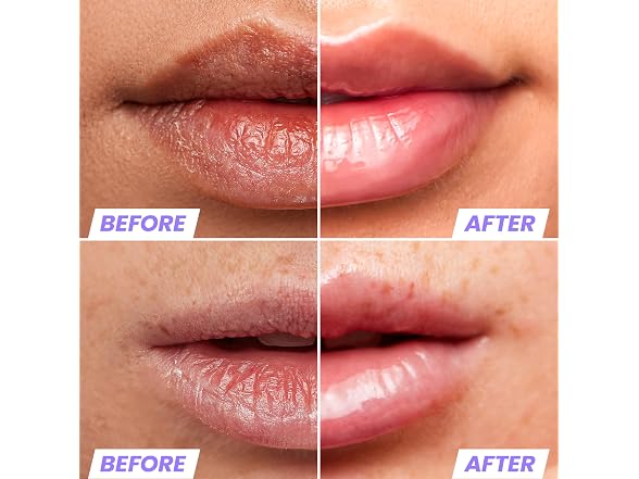 Wonderskin Lip Oil Rehab Serum Clear