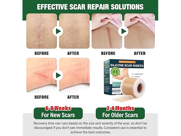 micakin Silicone Scar Tape