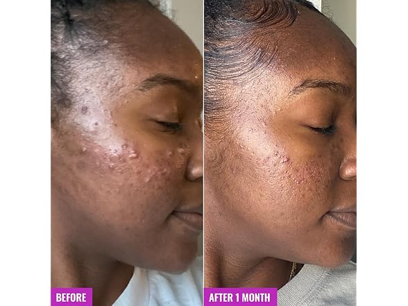 Good Molecules Acne Foaming Cleanser 2% Salicylic
