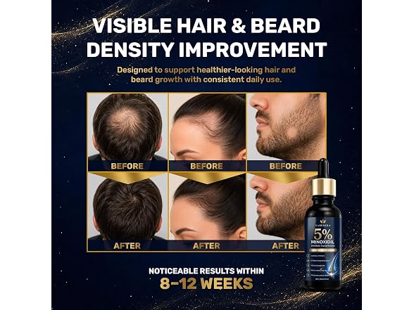 Yabercha 5% Minoxidil Kit for Men