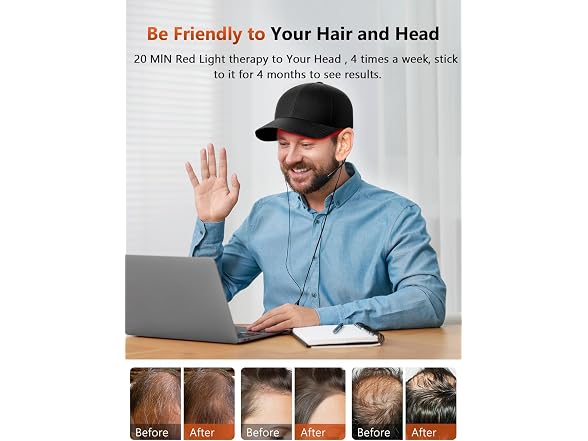 Red Light Therapy Cap