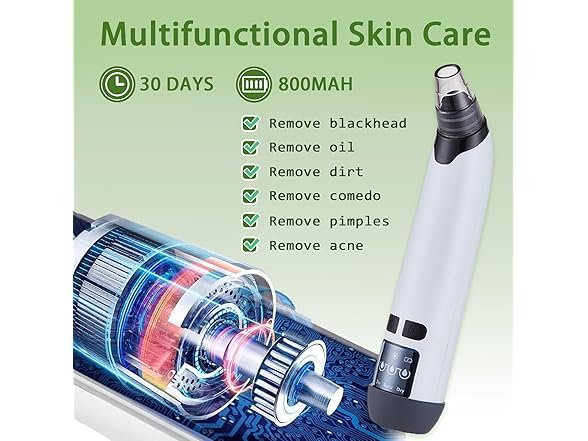 Xamoca Blackhead Remover Vacuum