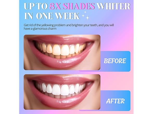 annecal Teeth Whitening Strips